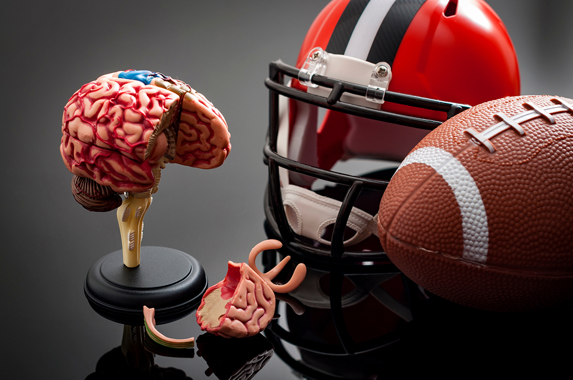 CONCUSSIONS CAUSE SERIOUS IMPACT